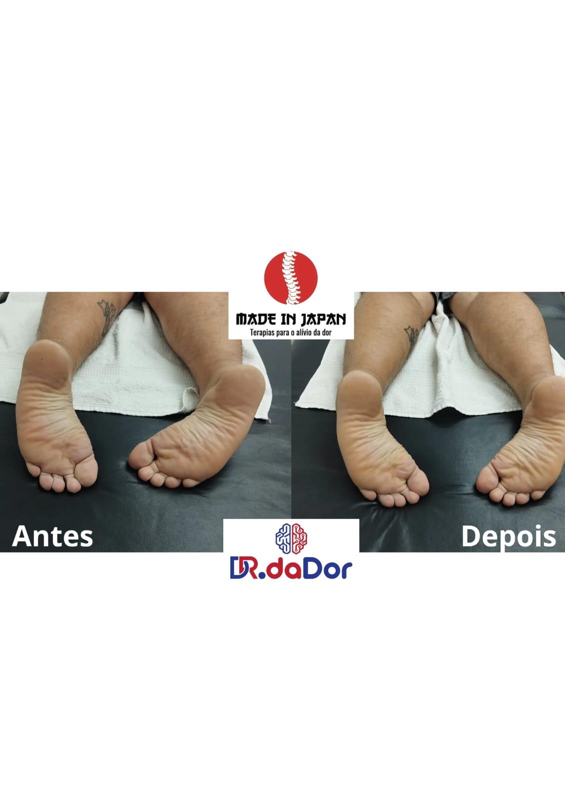 Doutor da Dor – Made in Japan — imagem 3